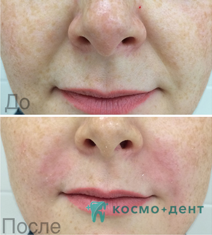 цены на контурную пластику в Красногорске