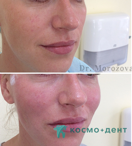 цены на контурную пластику в Красногорске