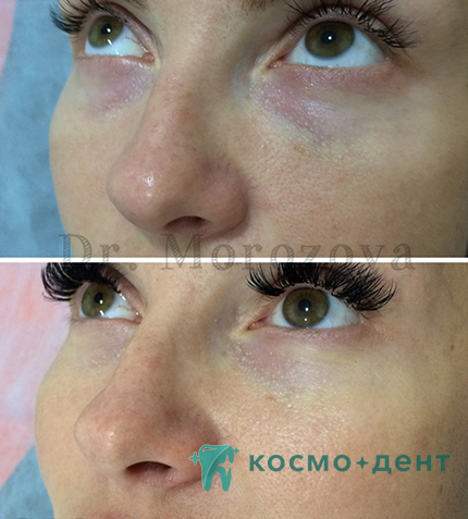 цены на контурную пластику в Красногорске